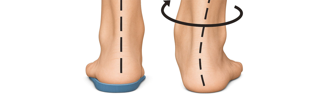 Insoles For Overpronation