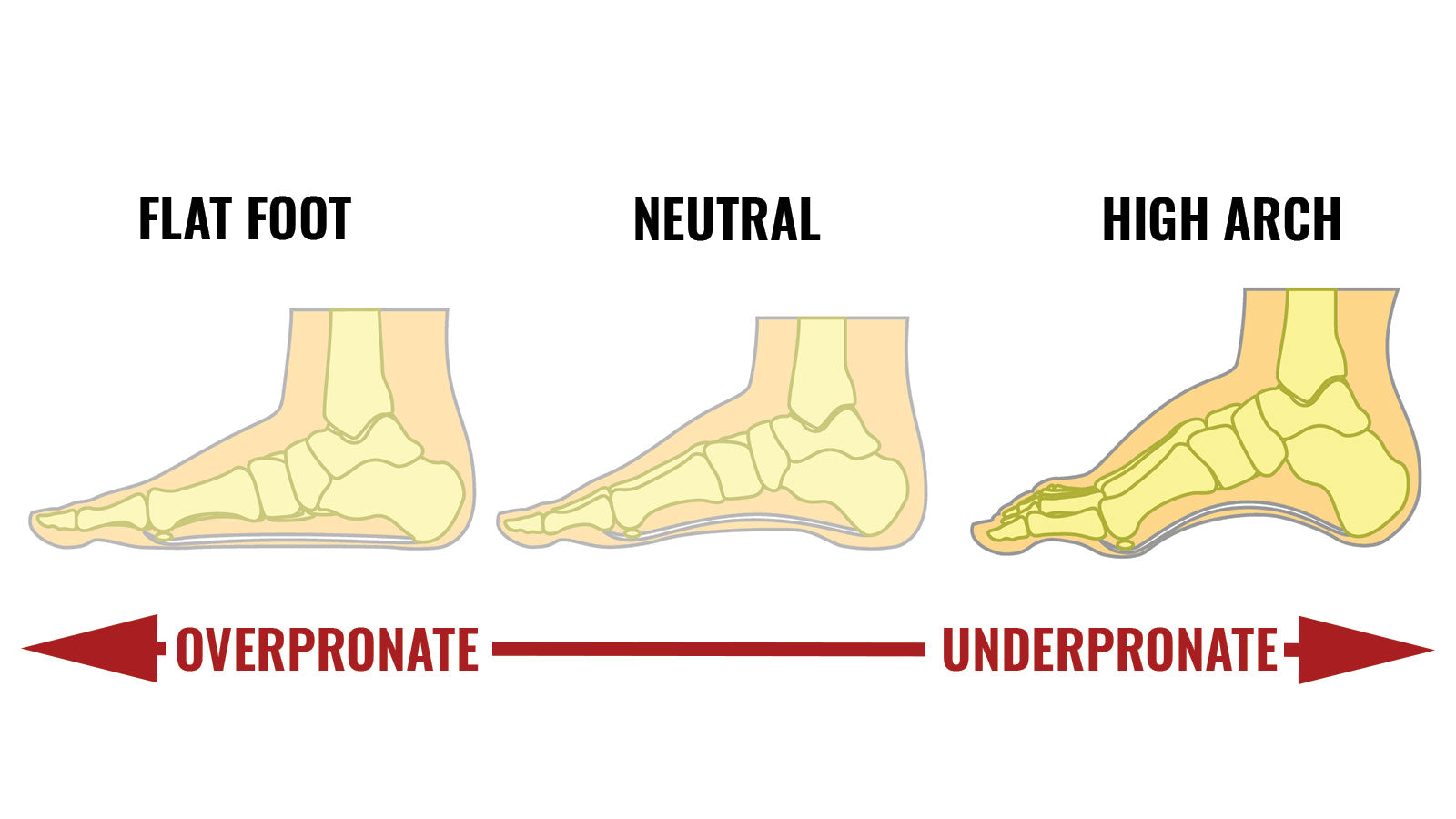 Insoles For High Arches